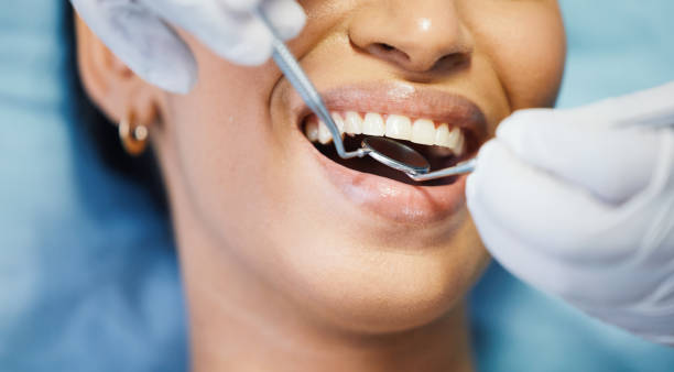 Best Emergency Dental Extractions in Racend, LA